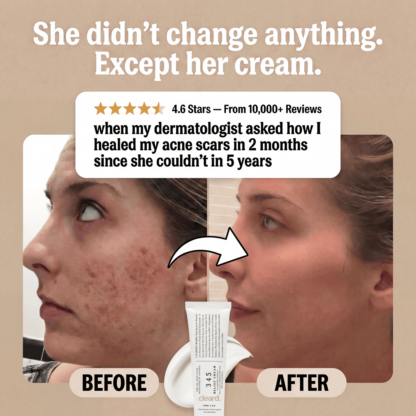 cleard. Acne + Scar Recovery Cream