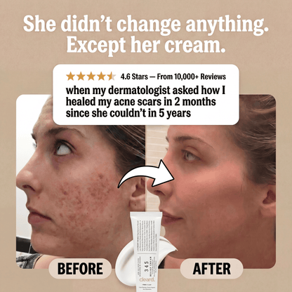 cleard. Acne + Scar Recovery Cream